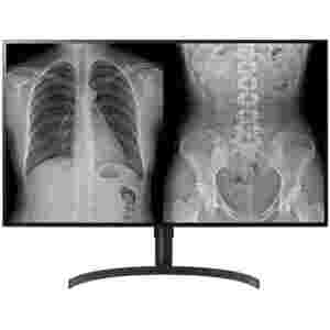 Monitor LG 80 cm (31